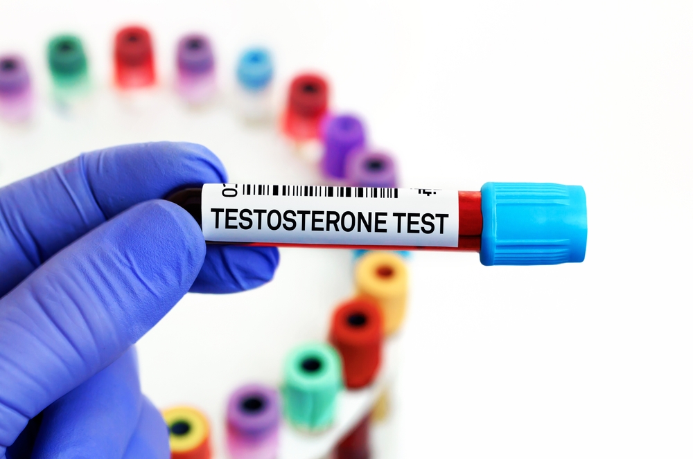 Testosterone Doctor in Bethesda